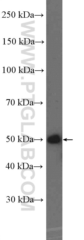 WB analysis of HeLa using 26497-1-AP