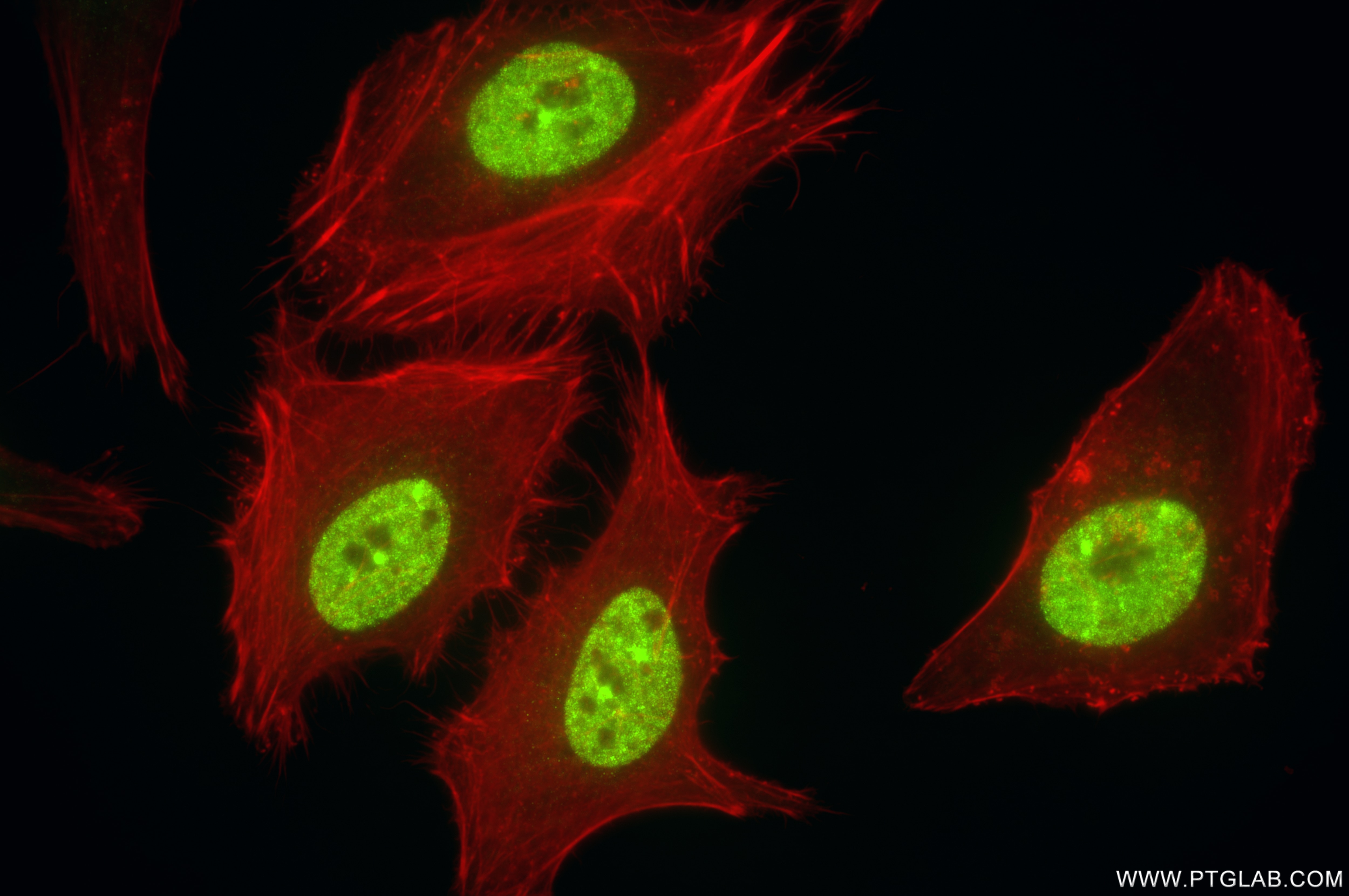 Immunofluorescence (IF) / fluorescent staining of HELA cells using HOXA10 Recombinant antibody (85951-2-RR)
