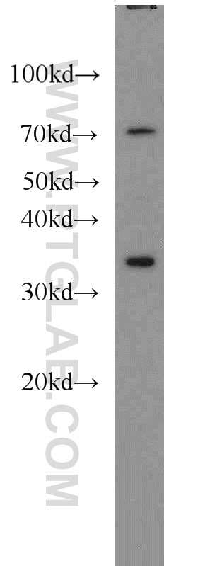 Western Blot (WB) analysis of HeLa cells using HOXA11 Polyclonal antibody (55495-1-AP)