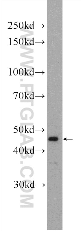 Western Blot (WB) analysis of Jurkat cells using HOXA2 Polyclonal antibody (25044-1-AP)