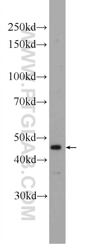 WB analysis of Jurkat using 25044-1-AP