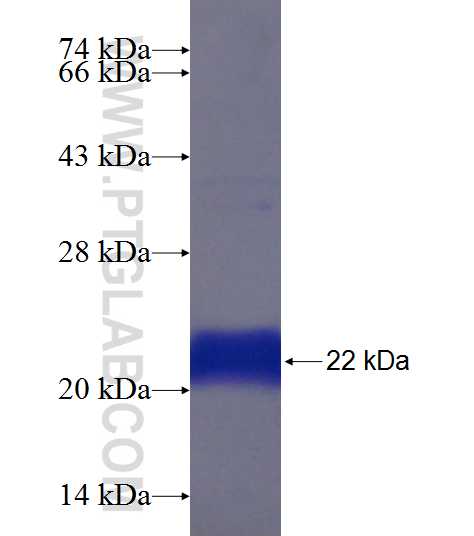 HOXA2 fusion protein Ag19577 SDS-PAGE