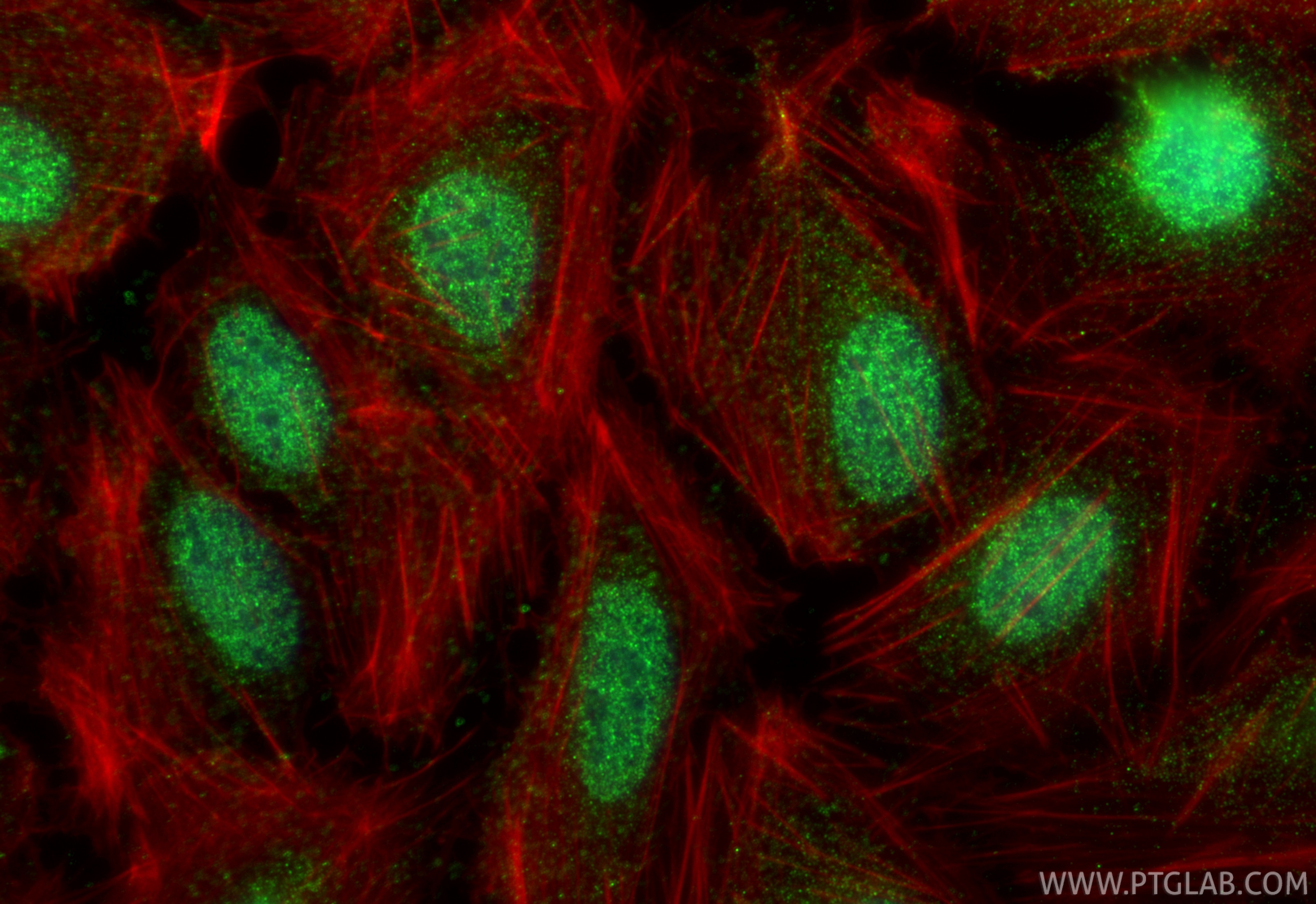 Immunofluorescence (IF) / fluorescent staining of U2OS cells using HOXA5 Polyclonal antibody (27622-1-AP)