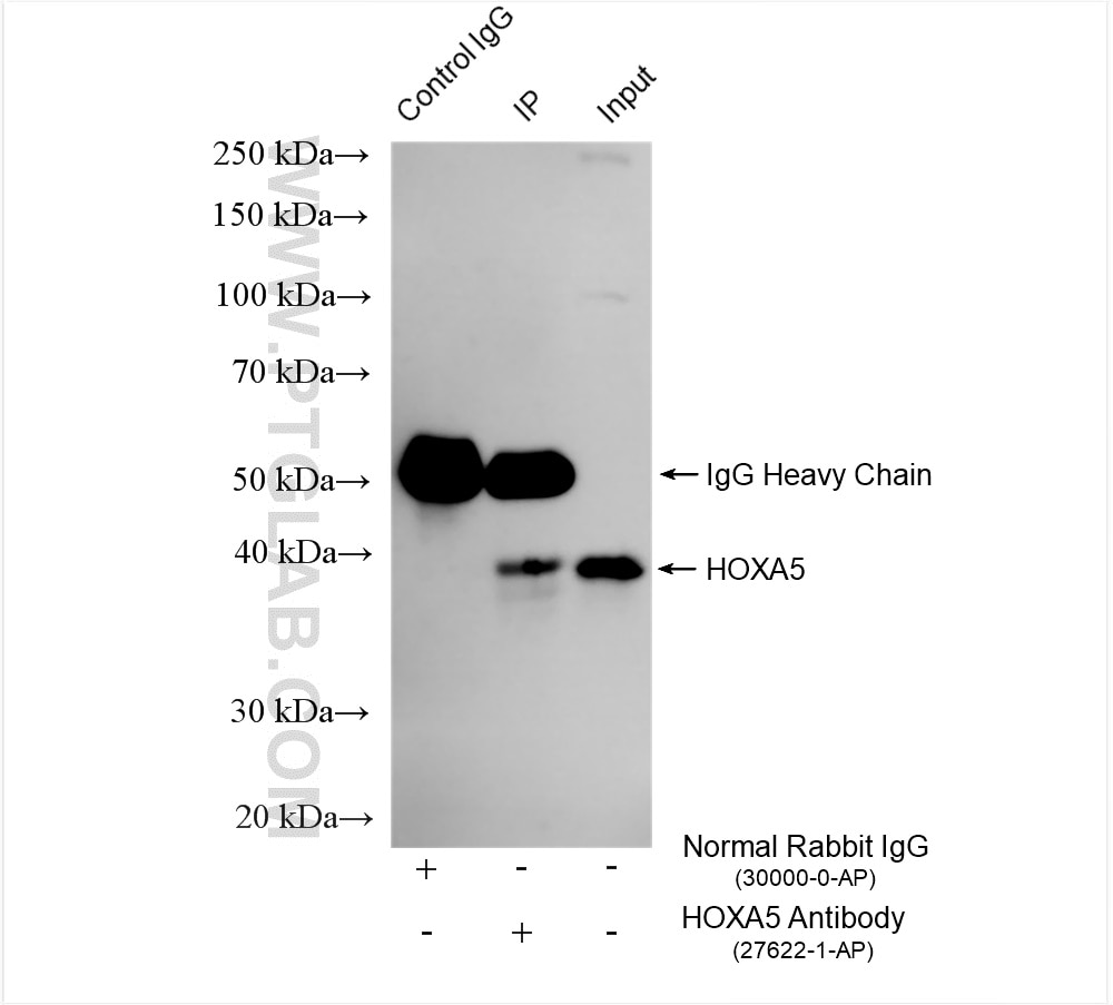 Immunoprecipitation (IP) experiment of HEK-293 cells using HOXA5 Polyclonal antibody (27622-1-AP)