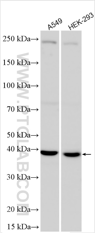 HOXA5