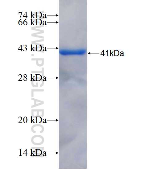 HOXA5 fusion protein Ag26362 SDS-PAGE