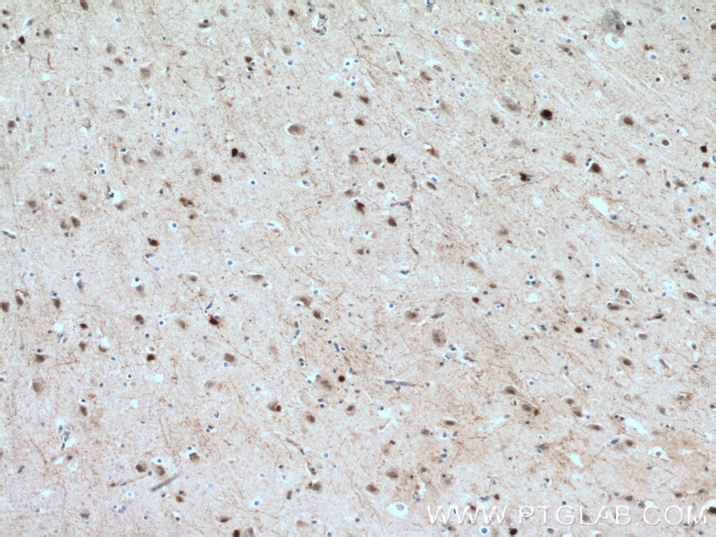 Immunohistochemistry (IHC) staining of human brain tissue using HOXA6 Polyclonal antibody (18210-1-AP)
