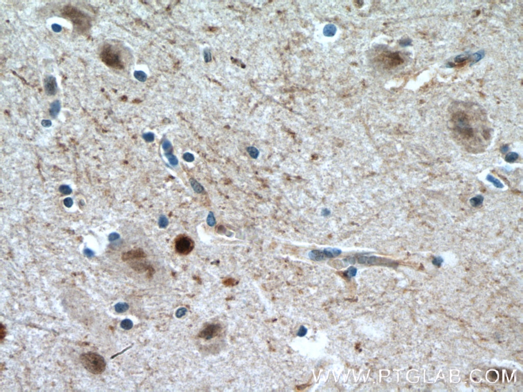 Immunohistochemistry (IHC) staining of human brain tissue using HOXA6 Polyclonal antibody (18210-1-AP)