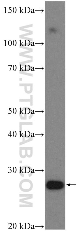 Western Blot (WB) analysis of mouse brain tissue using HOXA6 Polyclonal antibody (18210-1-AP)