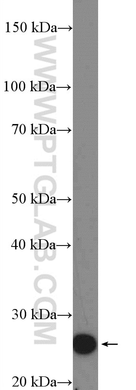 Western Blot (WB) analysis of mouse brain tissue using HOXA6 Polyclonal antibody (18210-1-AP)