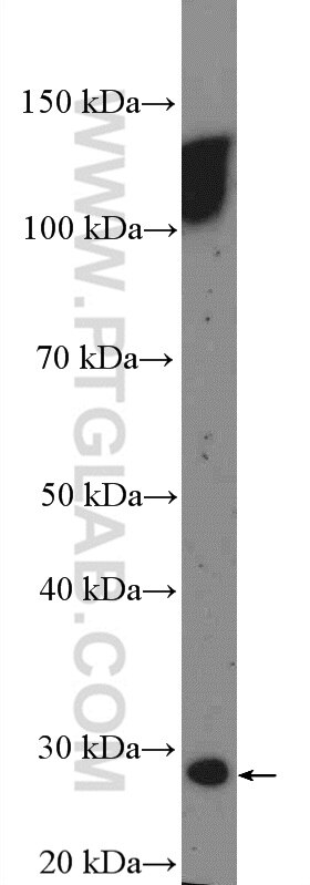 Western Blot (WB) analysis of mouse brain tissue using HOXA6 Polyclonal antibody (18210-1-AP)