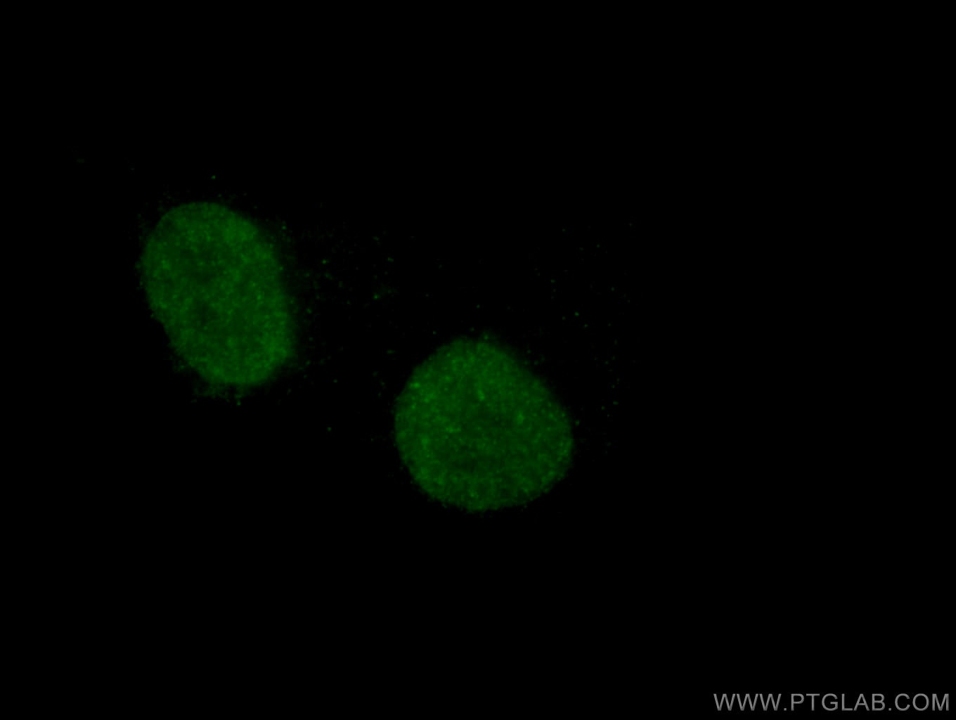 Immunofluorescence (IF) / fluorescent staining of HepG2 cells using HOXA7 Monoclonal antibody (67112-1-Ig)