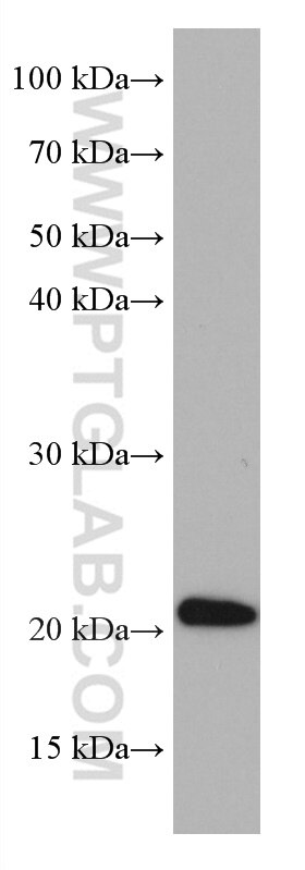 Western Blot (WB) analysis of SMMC-7721 cells using HOXA7 Monoclonal antibody (67112-1-Ig)