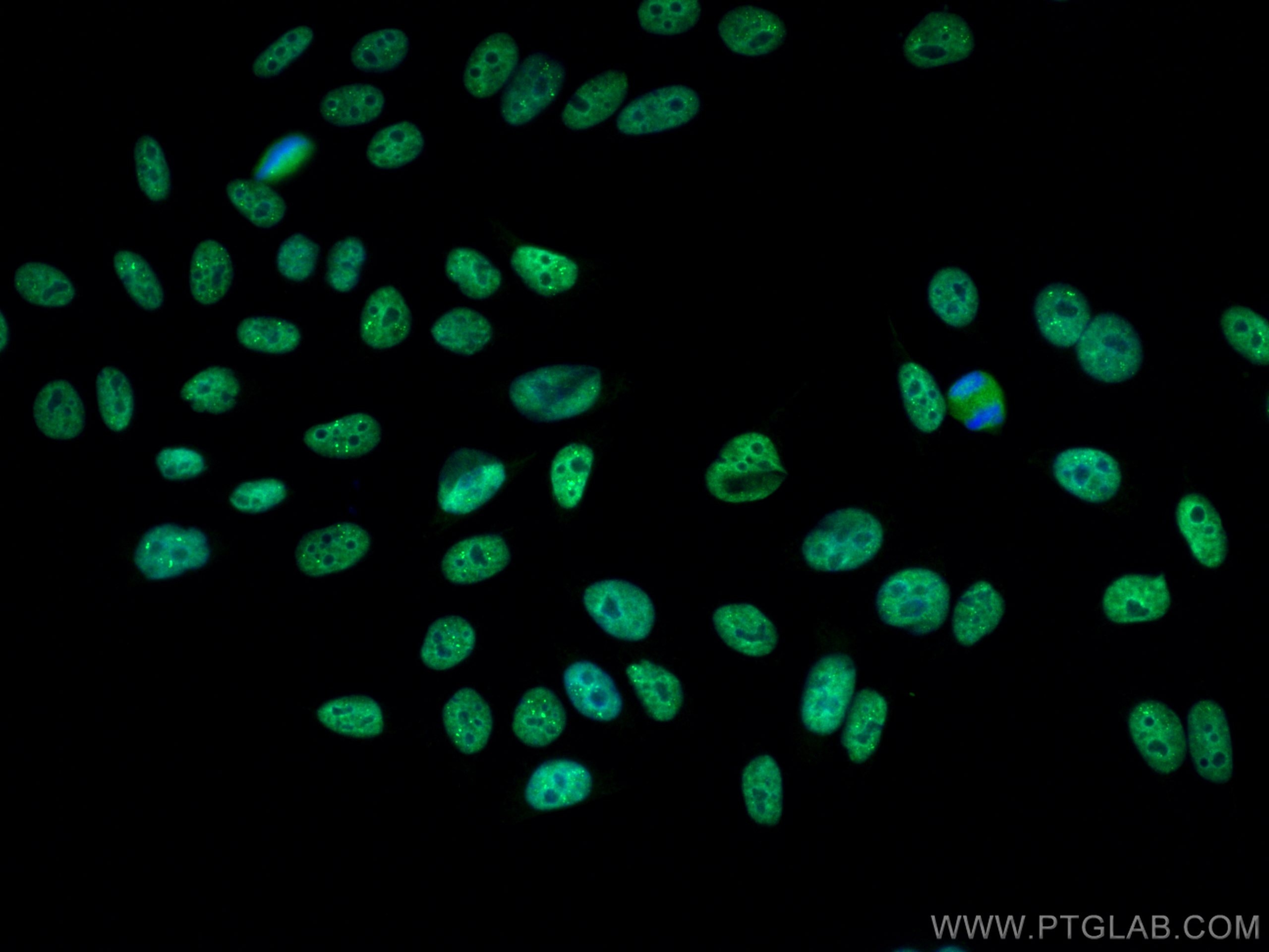 Immunofluorescence (IF) / fluorescent staining of HepG2 cells using CoraLite® Plus 488-conjugated HOXA7 Monoclonal ant (CL488-67112)
