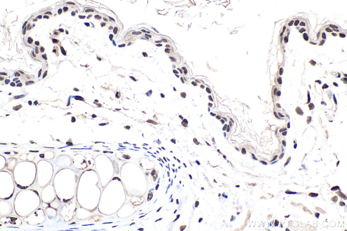 Immunohistochemistry (IHC) staining of mouse skin tissue using HOXA9 Polyclonal antibody (18501-1-AP)