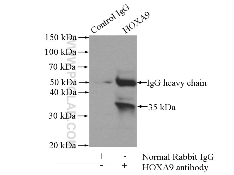 Immunoprecipitation (IP) experiment of mouse appendix tissue using HOXA9 Polyclonal antibody (18501-1-AP)