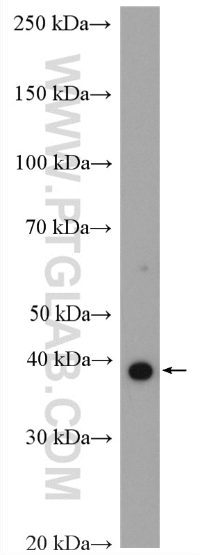 Western Blot (WB) analysis of EC109 cells using HOXA9 Polyclonal antibody (18501-1-AP)