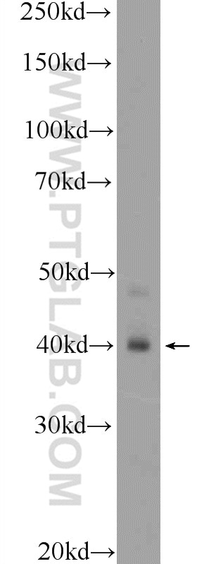 Western Blot (WB) analysis of mouse colon tissue using HOXA9 Polyclonal antibody (18501-1-AP)