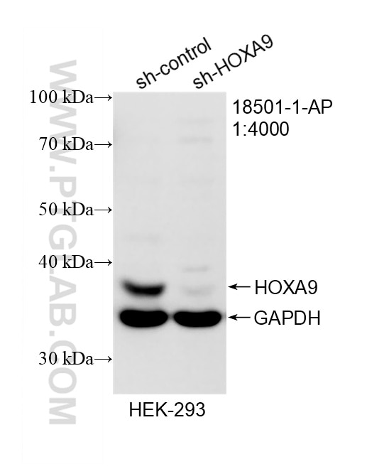 Western Blot (WB) analysis of HEK-293 cells using HOXA9 Polyclonal antibody (18501-1-AP)
