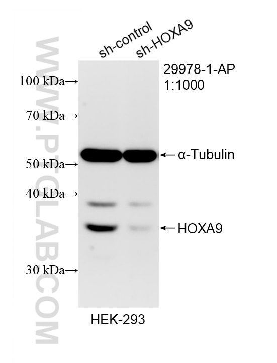WB analysis of HEK-293 using 29978-1-AP (same clone as 29978-1-PBS) Western Blot (WB) analysis of HEK-293 cells using HOXA9 Polyclonal antibody (29978-1-AP)