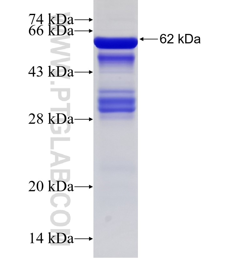 HOXA9 fusion protein Ag13350 SDS-PAGE