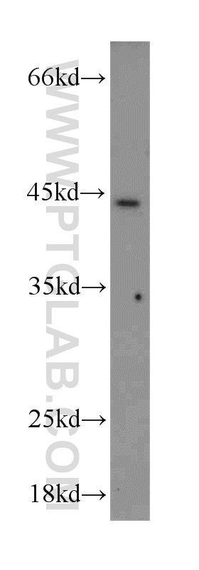 Western Blot (WB) analysis of mouse liver tissue using HOXB1 Polyclonal antibody (18732-1-AP)