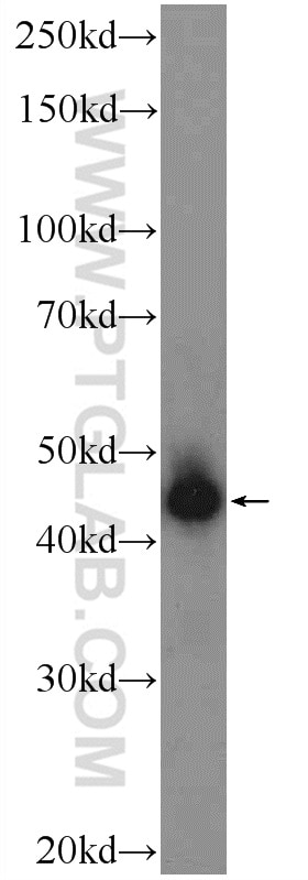Western Blot (WB) analysis of mouse brain tissue using HOXB1 Polyclonal antibody (21653-1-AP)
