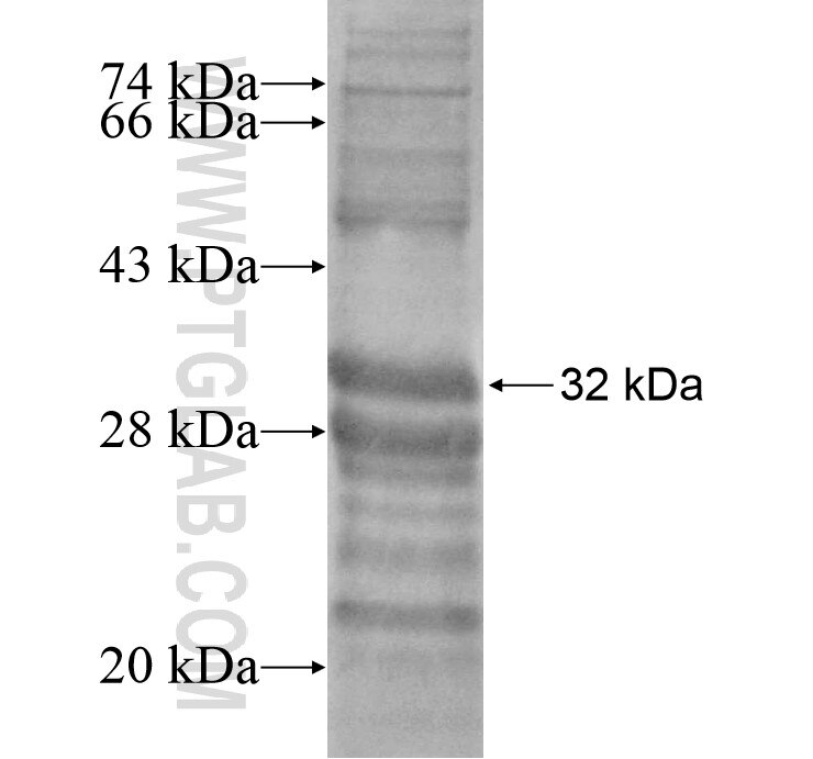 HOXB1 fusion protein Ag16759 SDS-PAGE