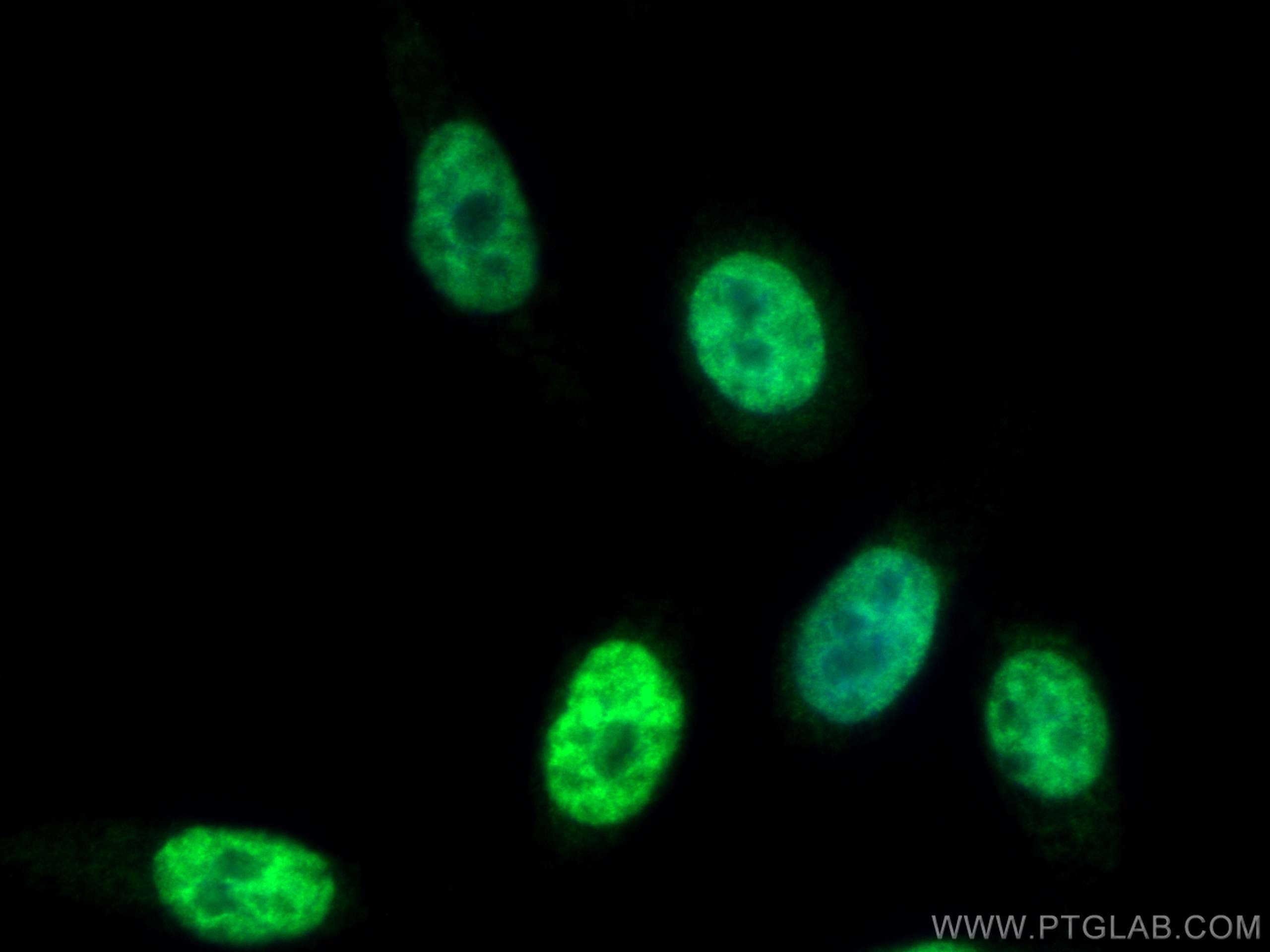Immunofluorescence (IF) / fluorescent staining of PC-3 cells using HOXB13 Polyclonal antibody (26384-1-AP)