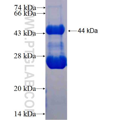 HOXB13 fusion protein Ag24757 SDS-PAGE