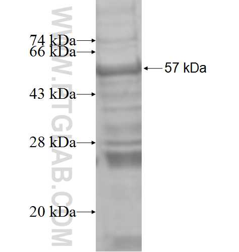 HOXB13 fusion protein Ag8476 SDS-PAGE