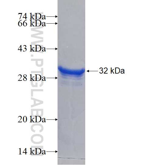 HOXB4 fusion protein Ag17761 SDS-PAGE