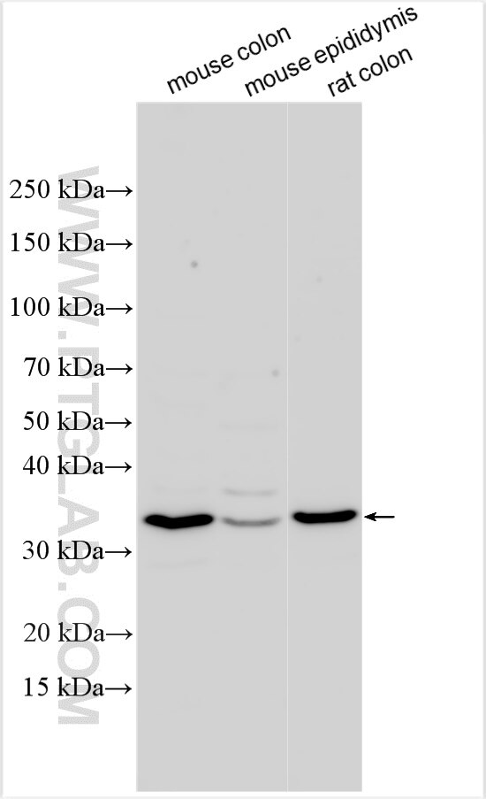 Western Blot (WB) analysis of various lysates using HOXB5 Polyclonal antibody (31552-1-AP)