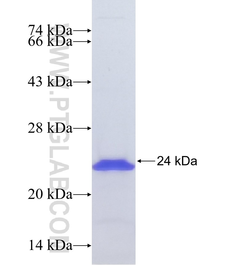 HOXB6 fusion protein Ag39469 SDS-PAGE HOXB6 fusion protein Ag39469 SDS-PAGE