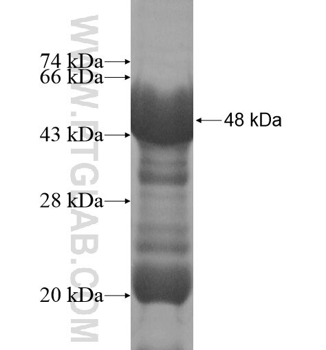 HOXB6 fusion protein Ag14189 SDS-PAGE