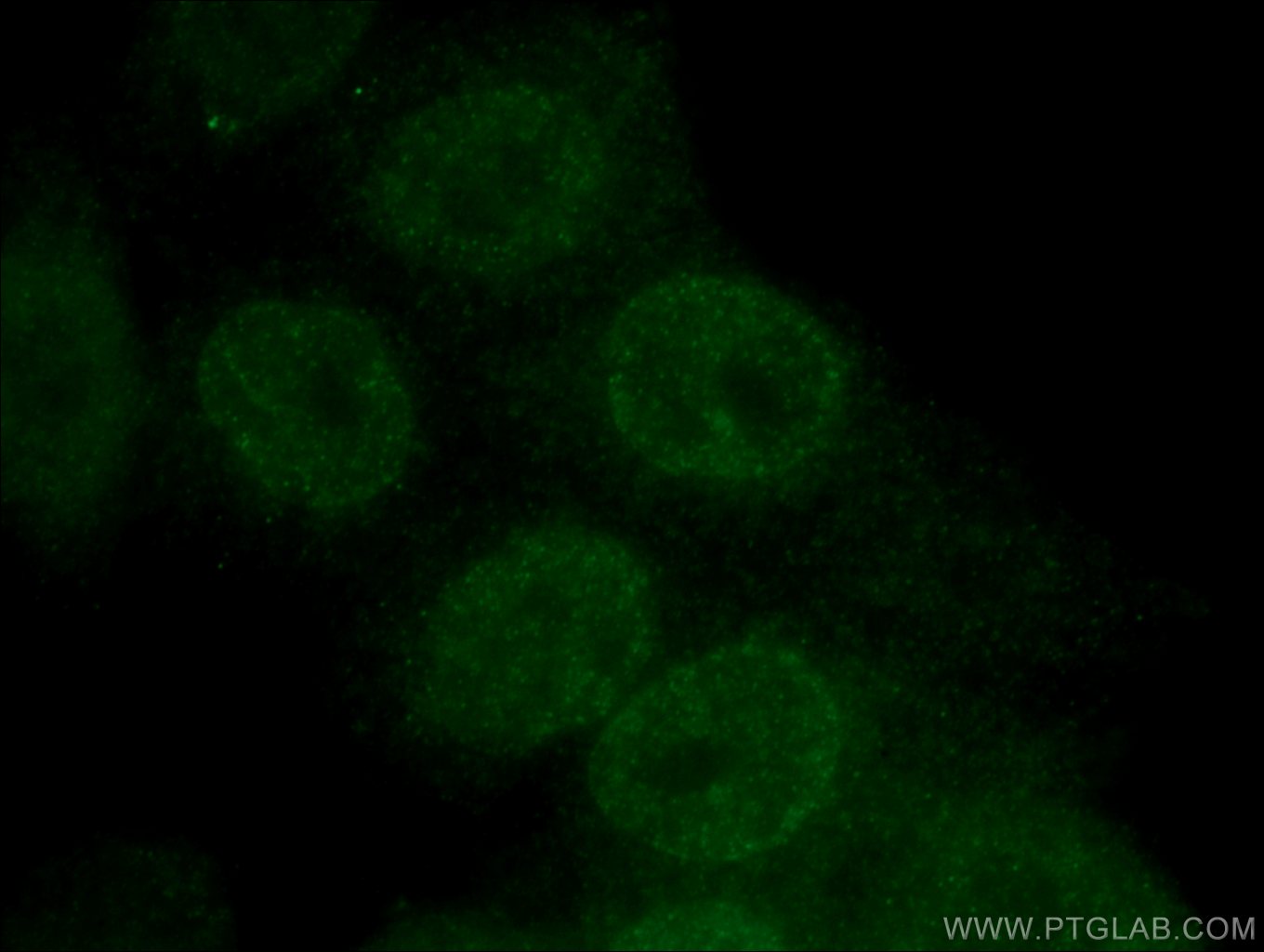 Immunofluorescence (IF) / fluorescent staining of HepG2 cells using HOXB7 Polyclonal antibody (12613-1-AP)