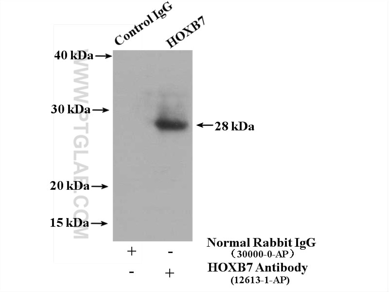 Immunoprecipitation (IP) experiment of SKOV-3 cells using HOXB7 Polyclonal antibody (12613-1-AP)