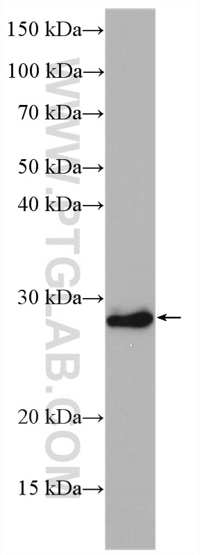 Western Blot (WB) analysis of SKOV-3 cells using HOXB7 Polyclonal antibody (12613-1-AP)