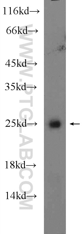 Western Blot (WB) analysis of SKOV-3 cells using HOXB7 Polyclonal antibody (12613-1-AP)