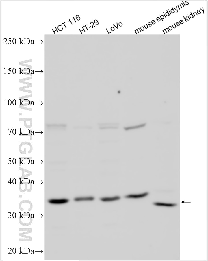 Western Blot (WB) analysis of various lysates using HOXB8 Polyclonal antibody (31387-1-AP)