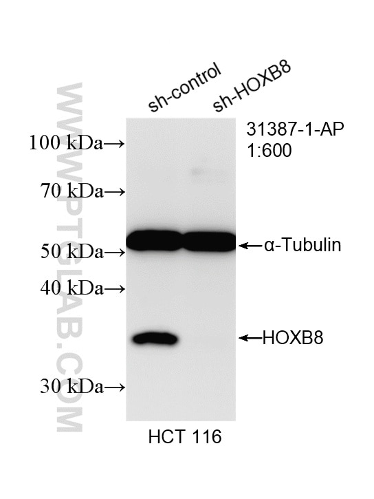 Western Blot (WB) analysis of HCT 116 cells using HOXB8 Polyclonal antibody (31387-1-AP)