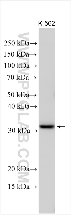 Western Blot (WB) analysis of various lysates using HOXB9 Polyclonal antibody (18894-1-AP)