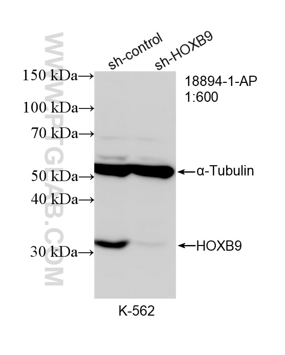 WB analysis of K-562 using 18894-1-AP (same clone as 18894-1-PBS) Western Blot (WB) analysis of K-562 cells using HOXB9 Polyclonal antibody (18894-1-AP)