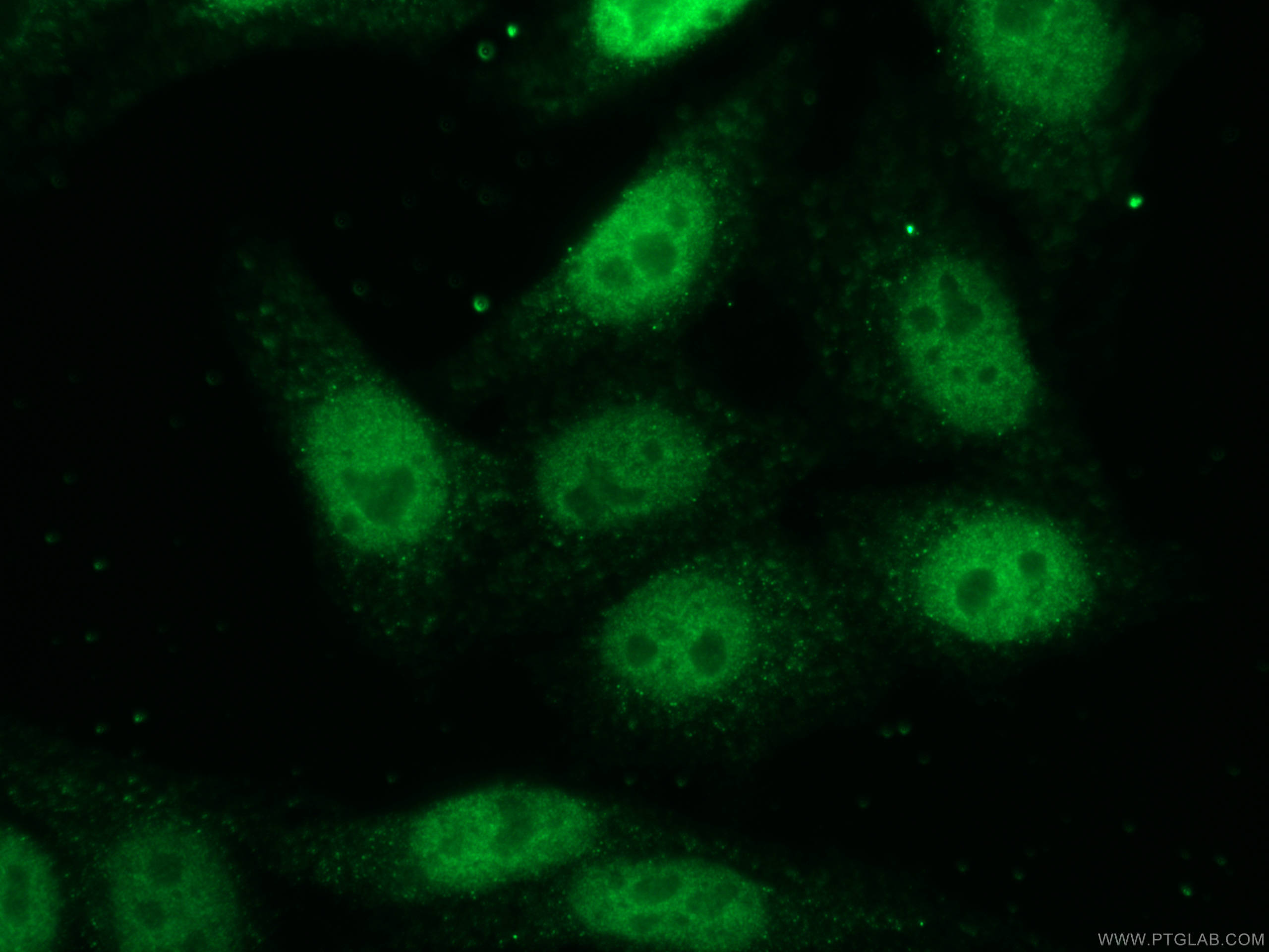 Immunofluorescence (IF) / fluorescent staining of HepG2 cells using HOXC10 Polyclonal antibody (12025-1-AP)