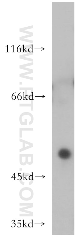 Western Blot (WB) analysis of mouse heart tissue using HOXC10 Polyclonal antibody (12025-1-AP)