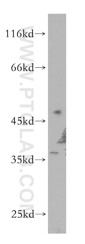 Western Blot (WB) analysis of A549 cells using HOXC10 Polyclonal antibody (12025-1-AP)