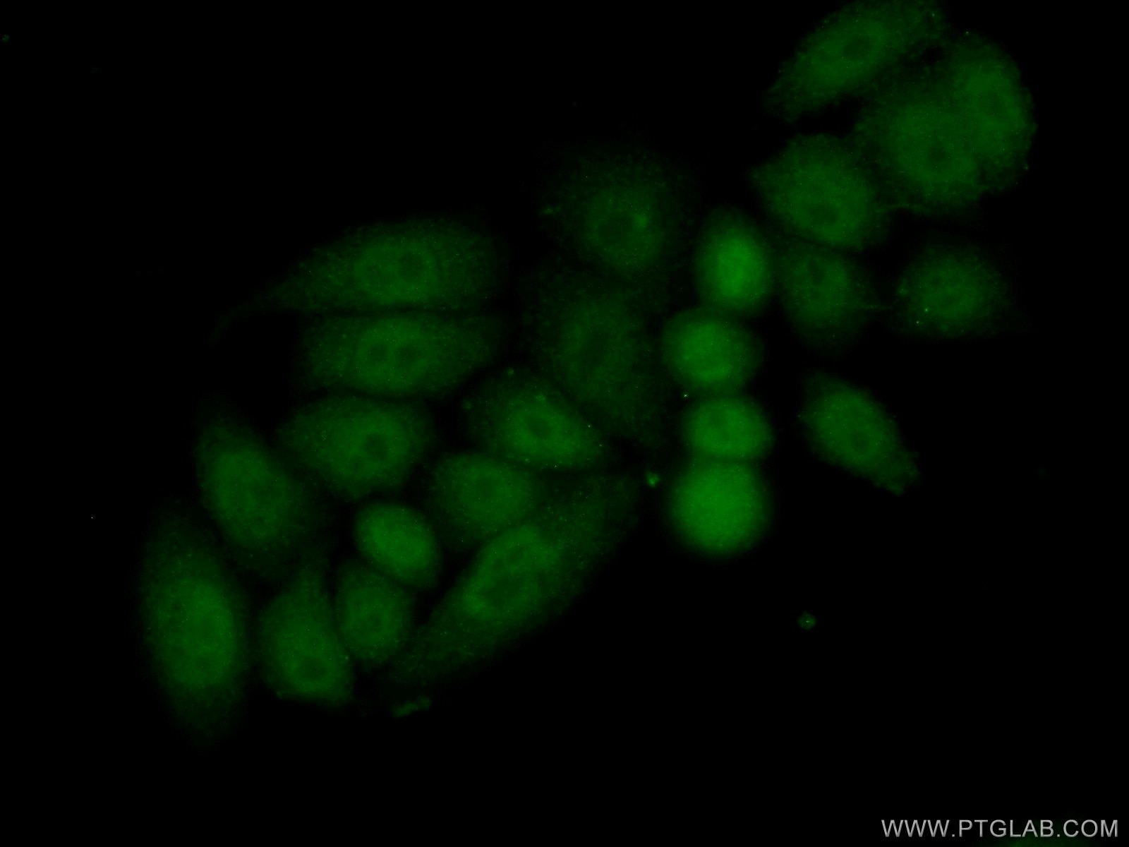 Immunofluorescence (IF) / fluorescent staining of HeLa cells using HOXC10 Polyclonal antibody (20632-1-AP)
