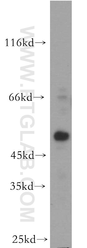 Western Blot (WB) analysis of HeLa cells using HOXC10 Polyclonal antibody (20632-1-AP)
