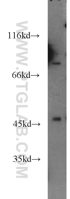 Western Blot (WB) analysis of HeLa cells using HOXC10 Polyclonal antibody (20632-1-AP)