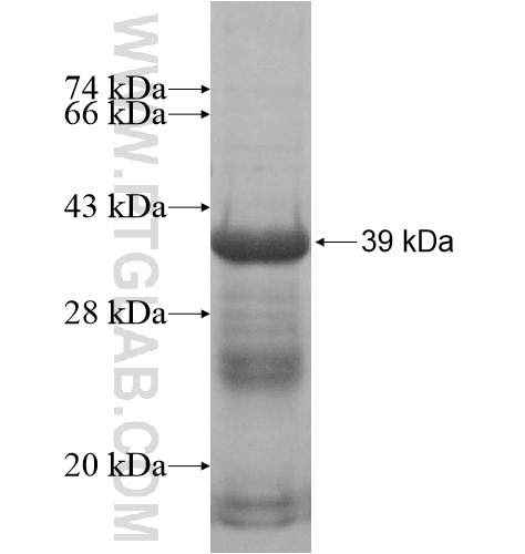 HOXC10 fusion protein Ag14608 SDS-PAGE